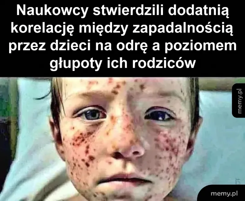 Chłopiec z wysypką na twarzy, wyglądający na zmartwionego.