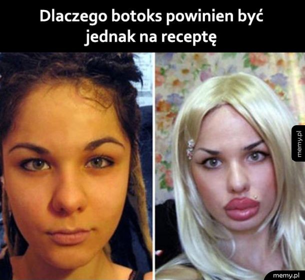 Właśnie dlatego