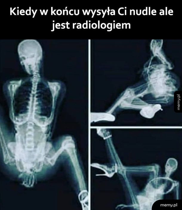 Niegrzeczna radiolożka