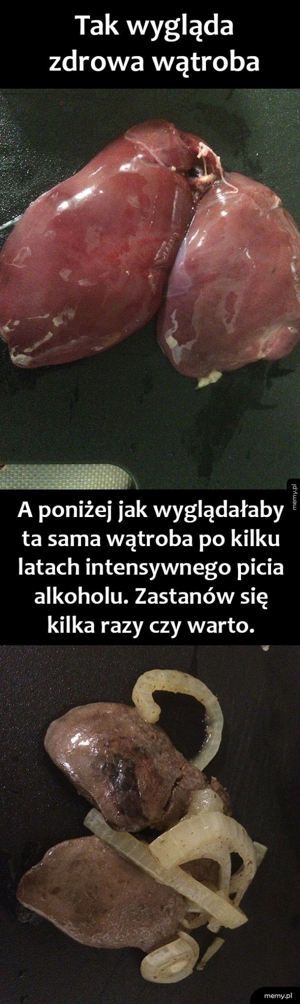 Wątroba przed i po