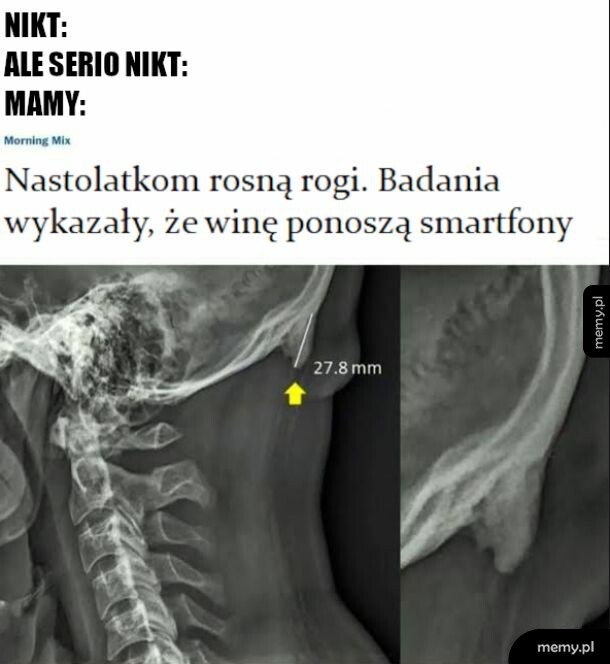 Łod promjeniowania i łucha pszy telefonie, udostępniajcie dalej chrońcie dzieci