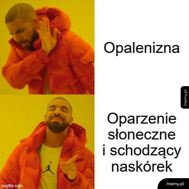 Opalenizna