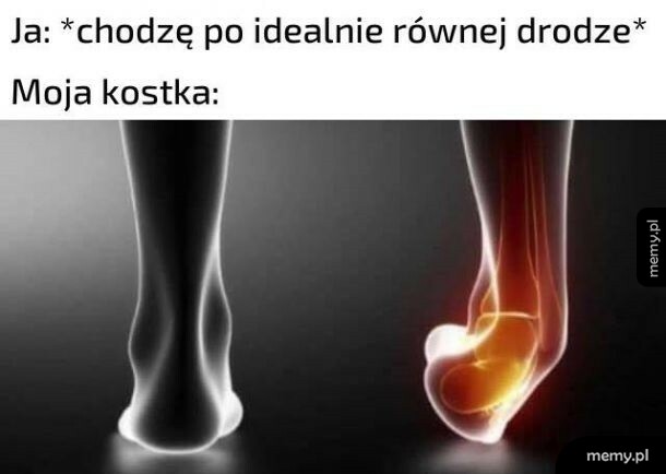 Zdarza się