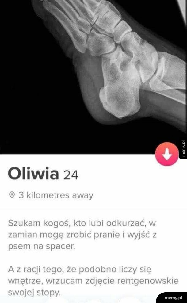 Profil randkowy kobiety o imieniu Oliwia z rentgenem stopy