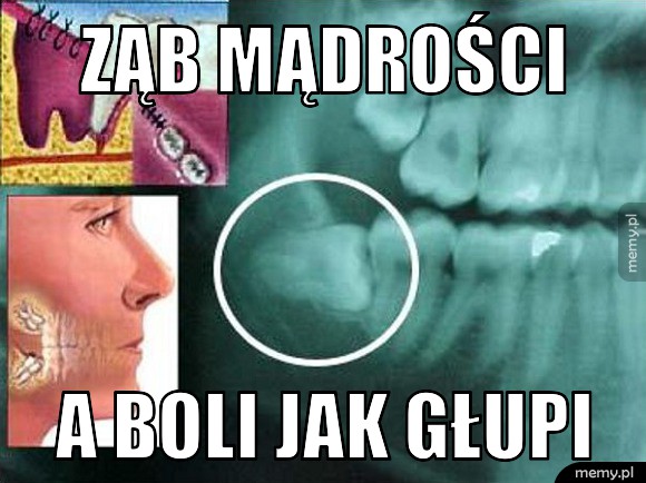 Ząb mądrości