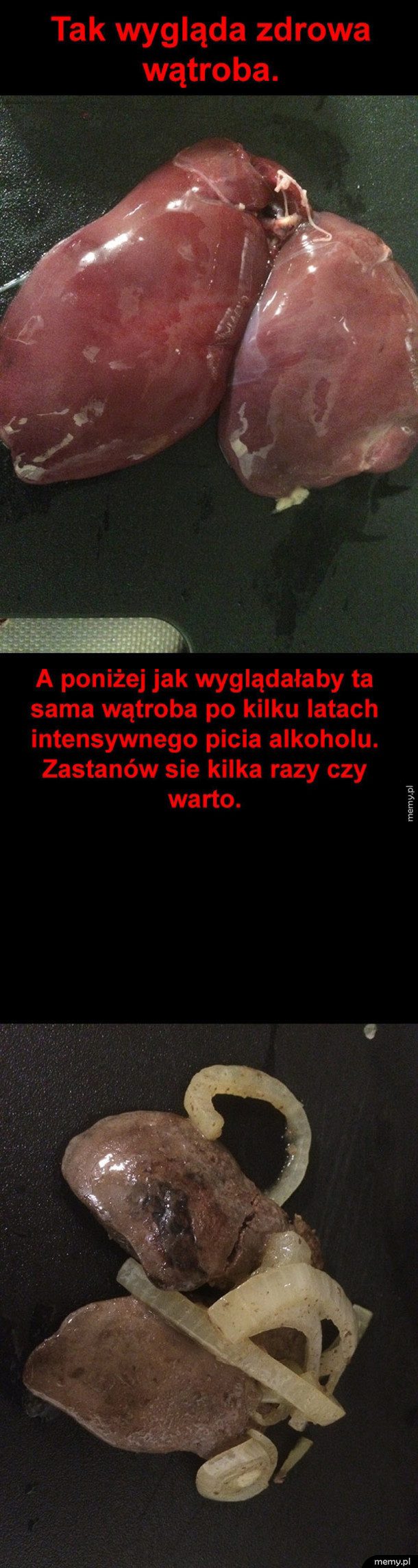 Wątroba